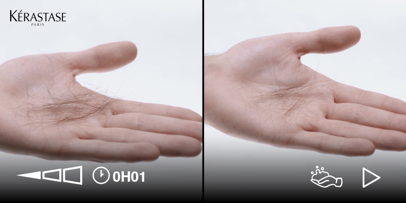 GENESIS HOMME - HAIR-FALL TEST Thumbnail