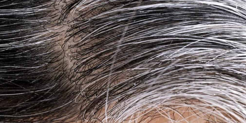 COL: COBERTURA DE CANAS Thumbnail