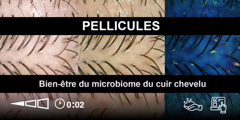 K-SCAN | PELLICULE