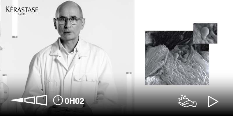 Caspa | Ciencia, Diagnóstico y Cuidado