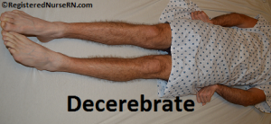 https://cdn5.dcbstatic.com/files/m/e/medpro_docebosaas_com/userfiles/20702/decerebrate.png