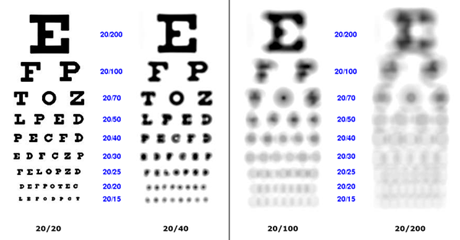https://cdn5.dcbstatic.com/files/m/e/medpro_docebosaas_com/userfiles/20702/eye_exam.png