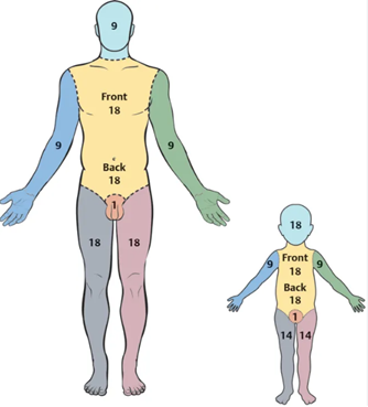 https://cdn5.dcbstatic.com/files/m/e/medpro_docebosaas_com/userfiles/20702/rule_of_nine.png